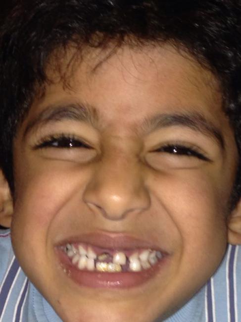 MOHAMED YASSIR